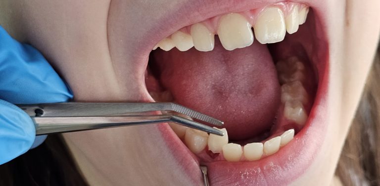 dental care